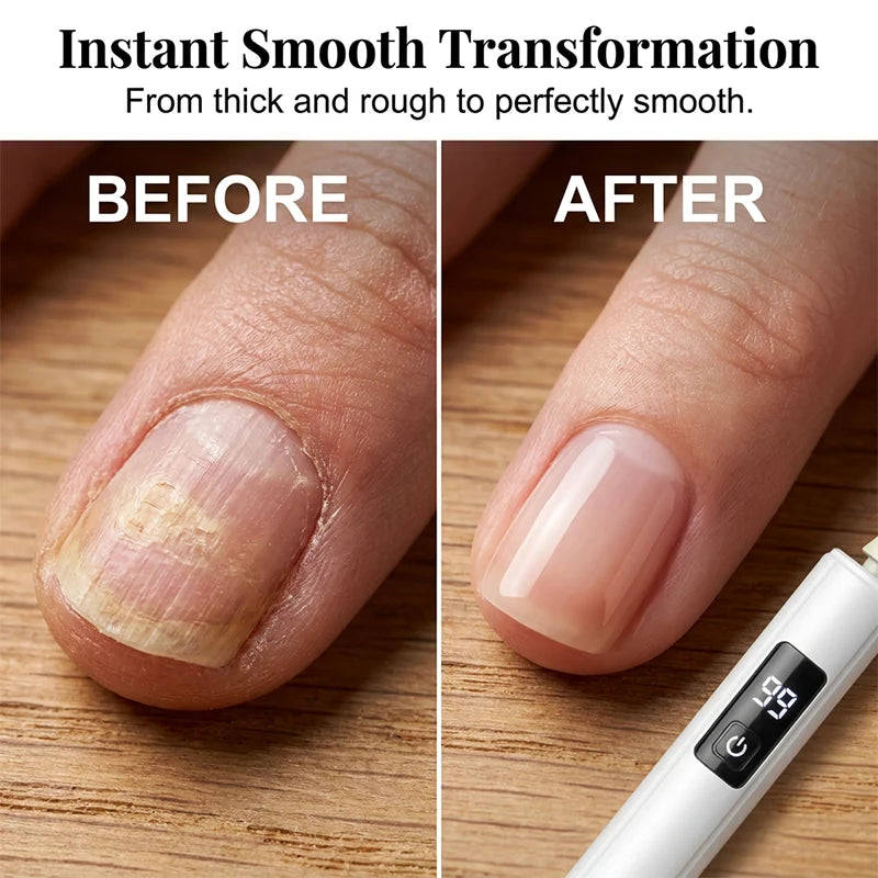 Purpose-Built Professional Electric Nail Polisher – Smooths thick