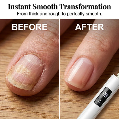 Purpose-Built Professional Electric Nail Polisher – Smooths thick