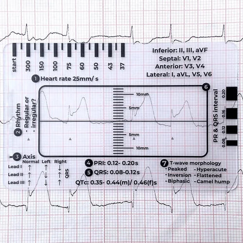Purpose-Built ECG 7 Step Ruler for Everyday Use