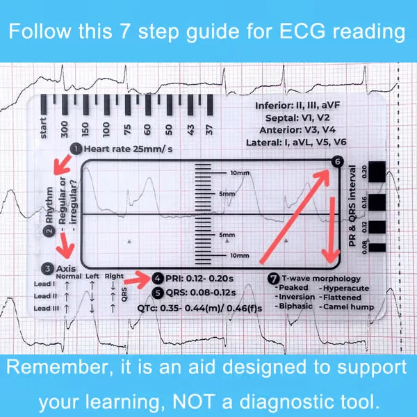 Purpose-Built ECG 7 Step Ruler for Everyday Use