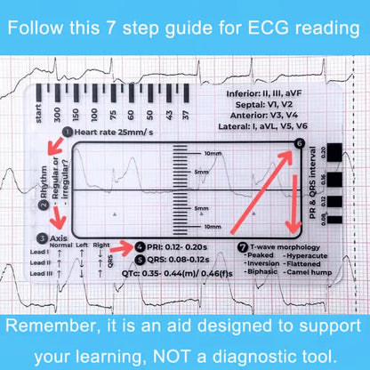 Purpose-Built ECG 7 Step Ruler for Everyday Use