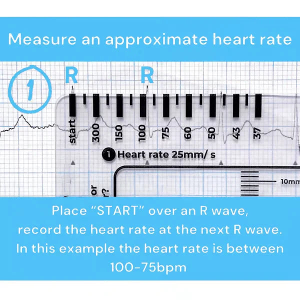 Purpose-Built ECG 7 Step Ruler for Everyday Use