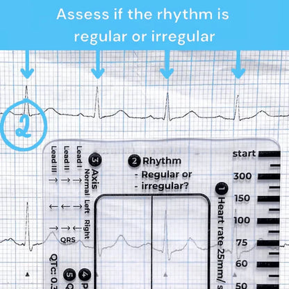 Purpose-Built ECG 7 Step Ruler for Everyday Use