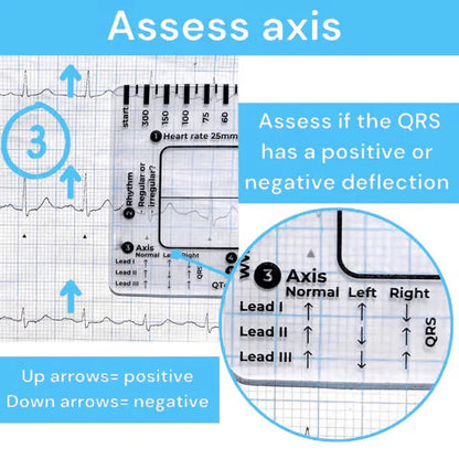Purpose-Built ECG 7 Step Ruler for Everyday Use