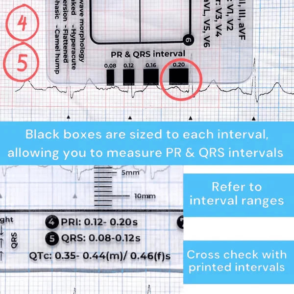 Purpose-Built ECG 7 Step Ruler for Everyday Use
