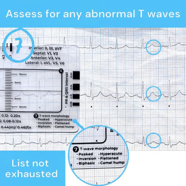 Purpose-Built ECG 7 Step Ruler for Everyday Use